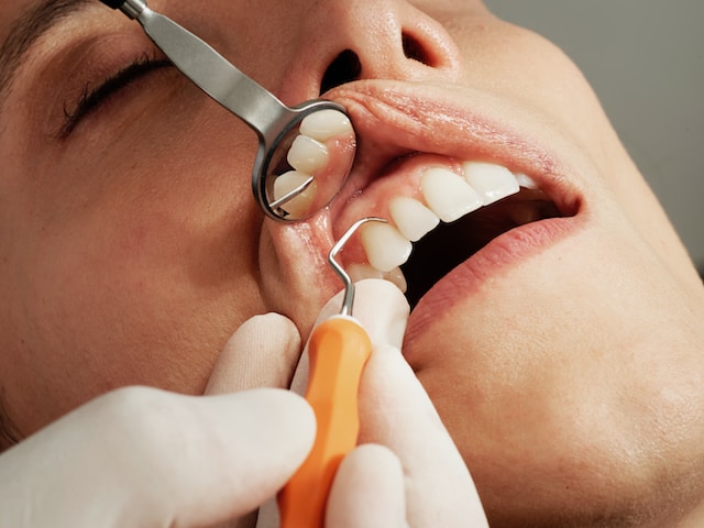 Dental Exam and Cleaning
