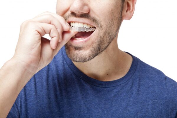 Invisalign London Ontario