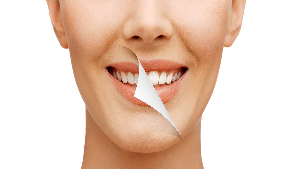 teeth whitening London Ontario