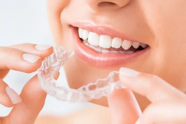 Invisalign in London