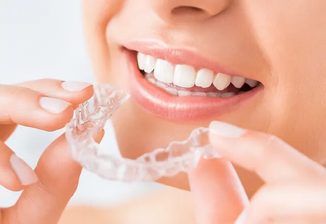 Invisalign in London